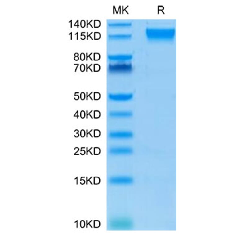 Tris-Bis PAGE - Recombinant Human CD100 Protein (Biotin) (C-terminal His and Avi Tag) (A330216) - Antibodies.com