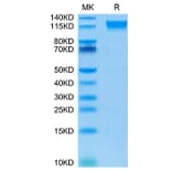 Tris-Bis PAGE - Recombinant Human CD100 Protein (Biotin) (C-terminal His and Avi Tag) (A330216) - Antibodies.com