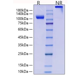 SDS-PAGE - Recombinant Human CD105 Protein (C-terminal Human Fc and His Tag) (A330217) - Antibodies.com