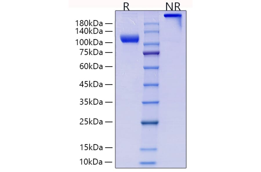 SDS-PAGE - Recombinant Human CD105 Protein (C-terminal Human Fc and His Tag) (A330217) - Antibodies.com