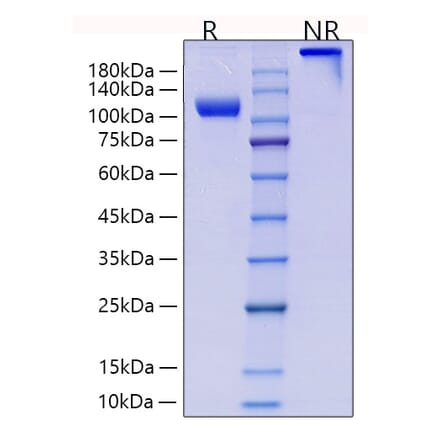 SDS-PAGE - Recombinant Human CD105 Protein (C-terminal Human Fc and His Tag) (A330217) - Antibodies.com