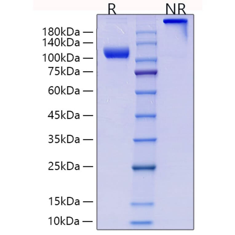 SDS-PAGE - Recombinant Human CD105 Protein (C-terminal Human Fc and His Tag) (A330217) - Antibodies.com
