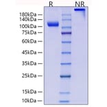 SDS-PAGE - Recombinant Human CD105 Protein (C-terminal Human Fc and His Tag) (A330217) - Antibodies.com