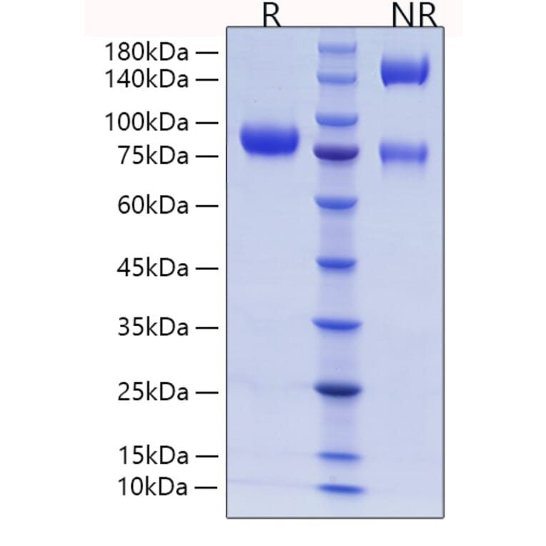 SDS-PAGE - Recombinant Human CD105 Protein (C-terminal His Tag) (A330218) - Antibodies.com