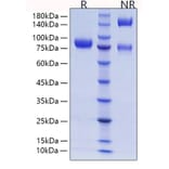 SDS-PAGE - Recombinant Human CD105 Protein (C-terminal His Tag) (A330218) - Antibodies.com
