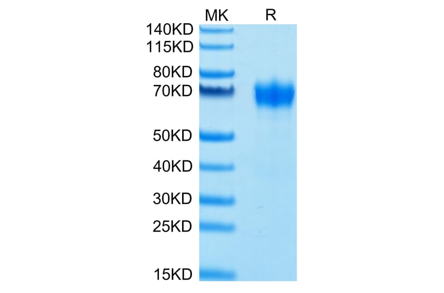Tris-Bis PAGE - Recombinant Human CD116 Protein (Biotin) (C-terminal His and Avi Tag) (A330219) - Antibodies.com