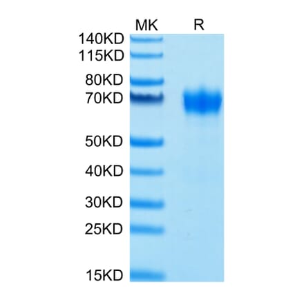 Tris-Bis PAGE - Recombinant Human CD116 Protein (Biotin) (C-terminal His and Avi Tag) (A330219) - Antibodies.com