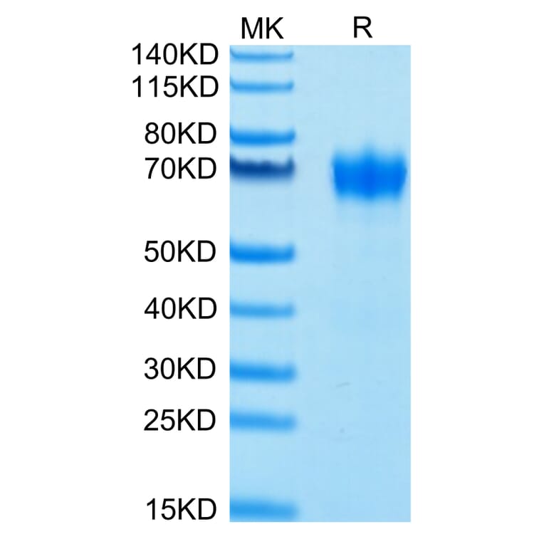 Tris-Bis PAGE - Recombinant Human CD116 Protein (Biotin) (C-terminal His and Avi Tag) (A330219) - Antibodies.com