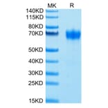 Tris-Bis PAGE - Recombinant Human CD116 Protein (Biotin) (C-terminal His and Avi Tag) (A330219) - Antibodies.com