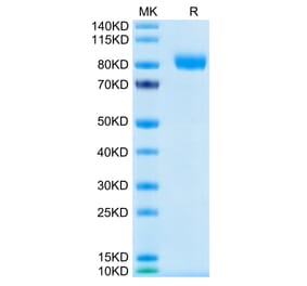 Tris-Bis PAGE - Recombinant Human CD116 Protein (C-terminal Human Fc Tag) (A330220) - Antibodies.com