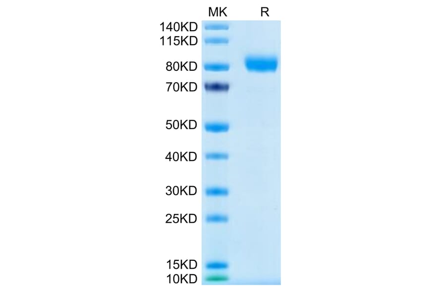 Tris-Bis PAGE - Recombinant Human CD116 Protein (C-terminal Human Fc Tag) (A330220) - Antibodies.com