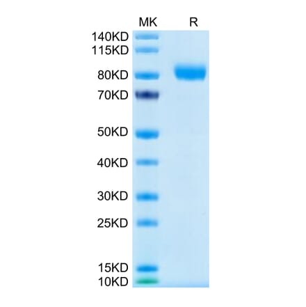 Tris-Bis PAGE - Recombinant Human CD116 Protein (C-terminal Human Fc Tag) (A330220) - Antibodies.com