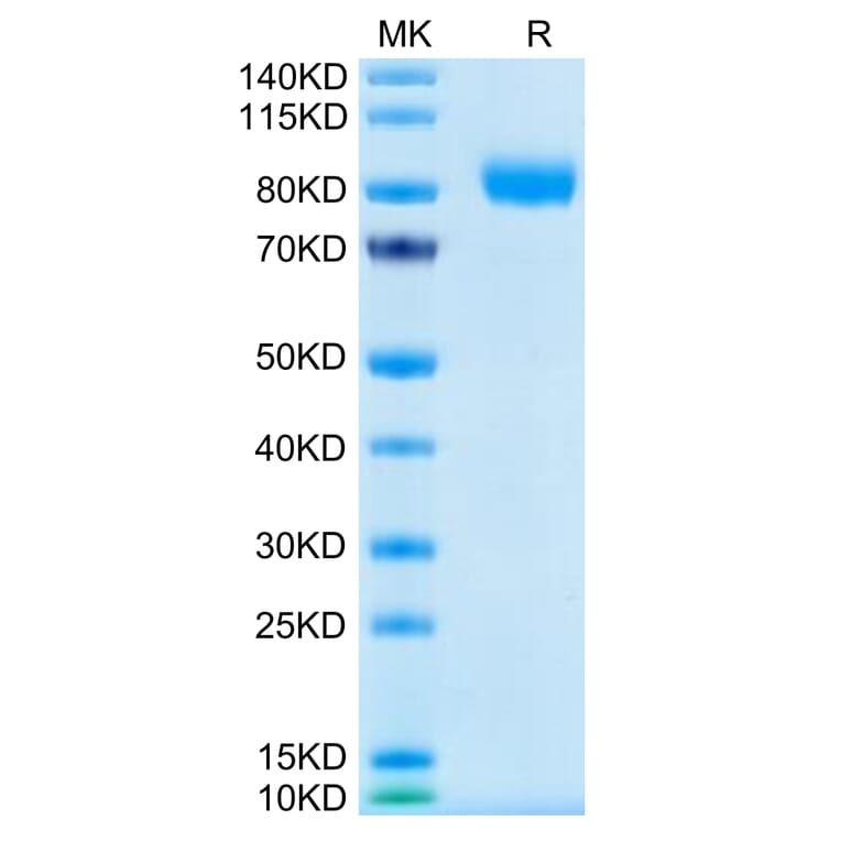 Tris-Bis PAGE - Recombinant Human CD116 Protein (C-terminal Human Fc Tag) (A330220) - Antibodies.com