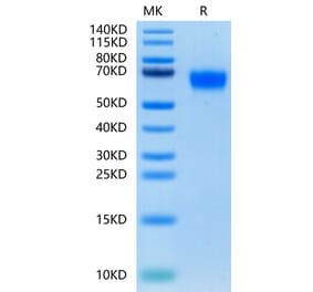 Tris-Bis PAGE - Recombinant Human CD116 Protein (C-terminal His Tag) (A330221) - Antibodies.com