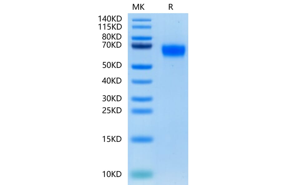 Tris-Bis PAGE - Recombinant Human CD116 Protein (C-terminal His Tag) (A330221) - Antibodies.com