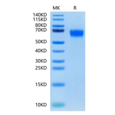 Tris-Bis PAGE - Recombinant Human CD116 Protein (C-terminal His Tag) (A330221) - Antibodies.com