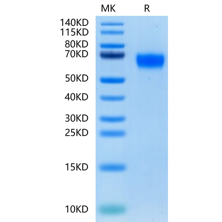 Tris-Bis PAGE - Recombinant Human CD116 Protein (C-terminal His Tag) (A330221) - Antibodies.com