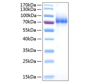 SDS-PAGE - Recombinant Human CD127 Protein (C-terminal Human Fc and His Tag) (A330222) - Antibodies.com