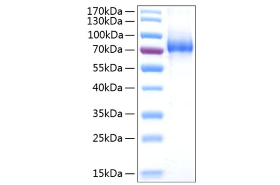 SDS-PAGE - Recombinant Human CD127 Protein (C-terminal Human Fc and His Tag) (A330222) - Antibodies.com