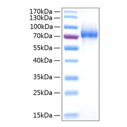SDS-PAGE - Recombinant Human CD127 Protein (C-terminal Human Fc and His Tag) (A330222) - Antibodies.com