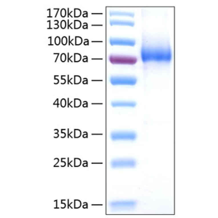 SDS-PAGE - Recombinant Human CD127 Protein (C-terminal Human Fc and His Tag) (A330222) - Antibodies.com