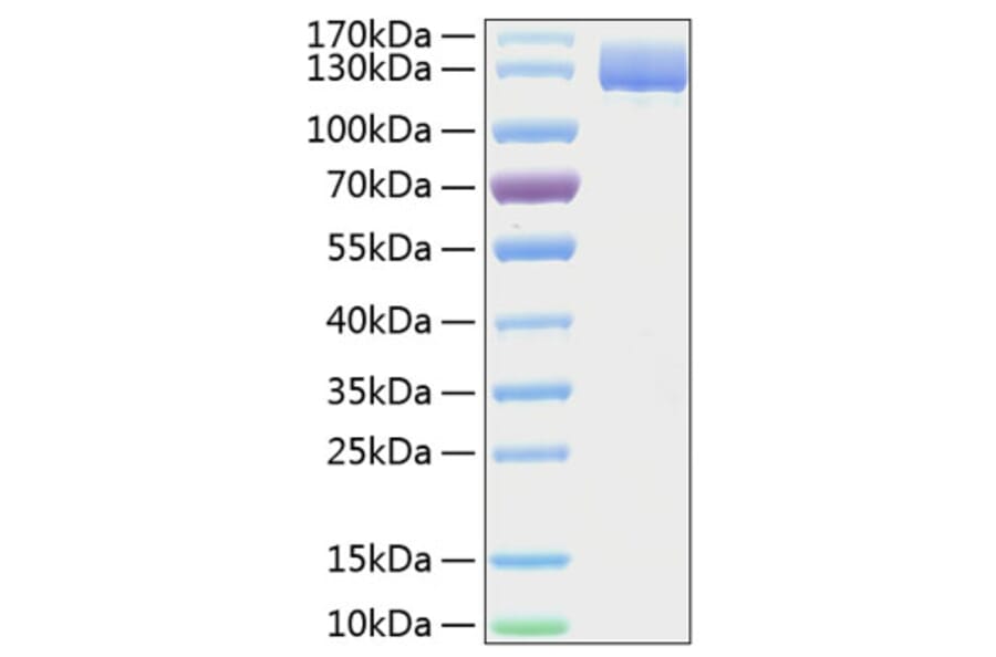 SDS-PAGE - Recombinant Human CD13 Protein (C-terminal His Tag) (A330223) - Antibodies.com