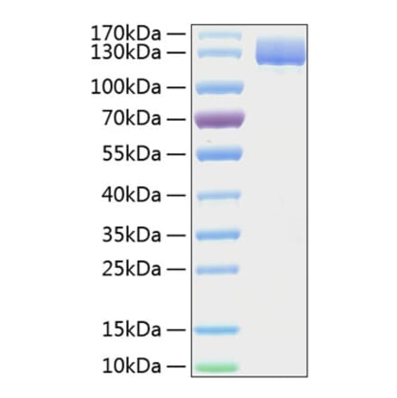 SDS-PAGE - Recombinant Human CD13 Protein (C-terminal His Tag) (A330223) - Antibodies.com