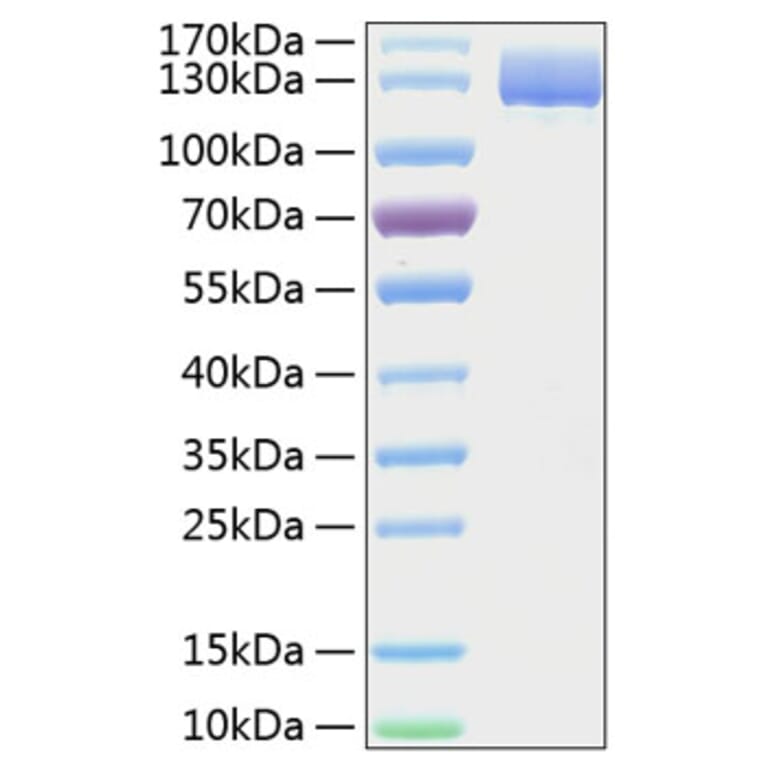 SDS-PAGE - Recombinant Human CD13 Protein (C-terminal His Tag) (A330223) - Antibodies.com
