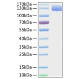 SDS-PAGE - Recombinant Human CD13 Protein (C-terminal His Tag) (A330223) - Antibodies.com
