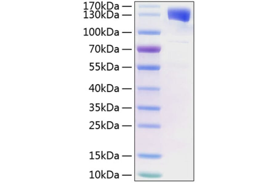 SDS-PAGE - Recombinant Human CD130 (gp130) Protein (C-terminal Human Fc and His Tag) (A330224) - Antibodies.com