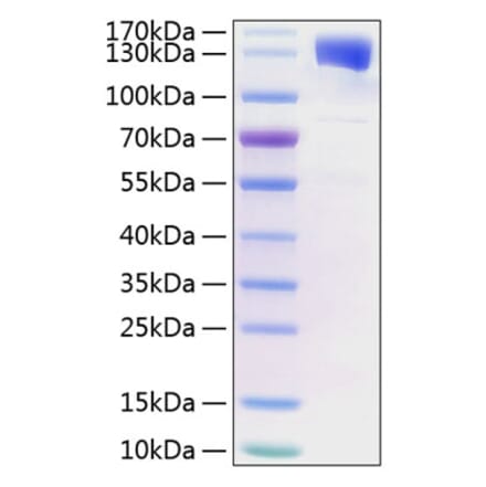 SDS-PAGE - Recombinant Human CD130 (gp130) Protein (C-terminal Human Fc and His Tag) (A330224) - Antibodies.com