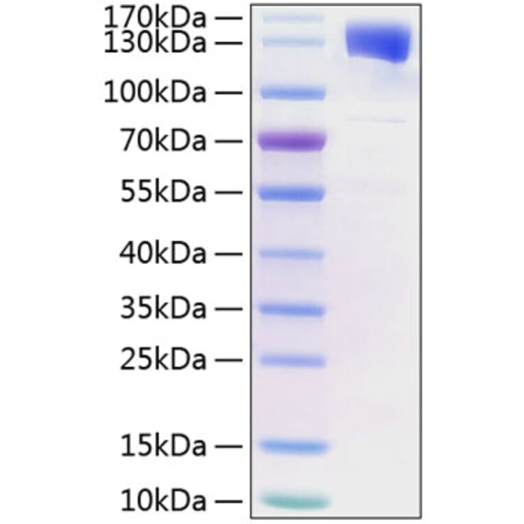 SDS-PAGE - Recombinant Human CD130 (gp130) Protein (C-terminal Human Fc and His Tag) (A330224) - Antibodies.com