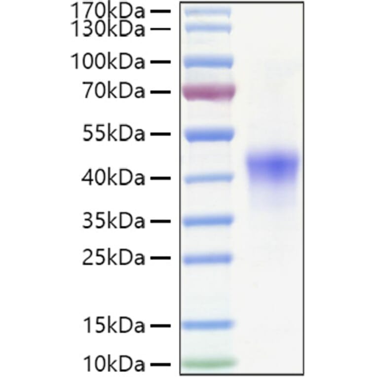 SDS-PAGE - Recombinant Human CD134/OX40L Receptor Protein (C-terminal His Tag) (A330225) - Antibodies.com