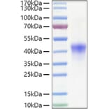 SDS-PAGE - Recombinant Human CD134/OX40L Receptor Protein (C-terminal His Tag) (A330225) - Antibodies.com