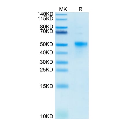 Tris-Bis PAGE - Recombinant Human CD134/OX40L Receptor Protein (Biotin) (C-terminal His and Avi Tag) (A330226) - Antibodies.com