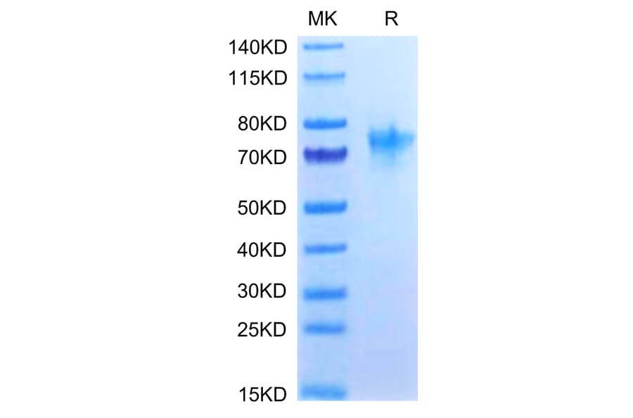 Tris-Bis PAGE - Recombinant Human CD134/OX40L Receptor Protein (C-terminal Human Fc Tag) (A330228) - Antibodies.com