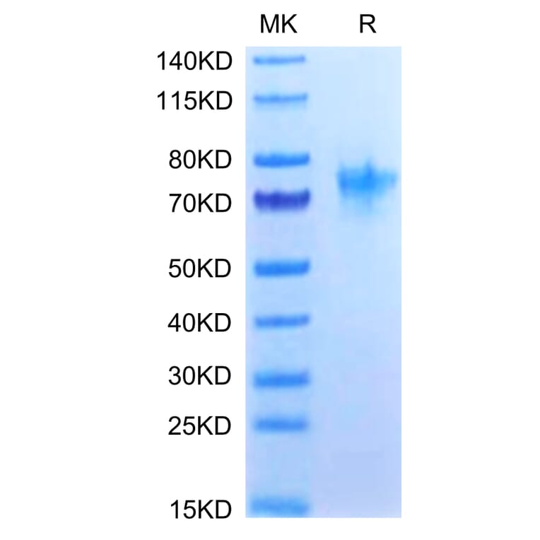 Tris-Bis PAGE - Recombinant Human CD134/OX40L Receptor Protein (C-terminal Human Fc Tag) (A330228) - Antibodies.com