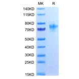 Tris-Bis PAGE - Recombinant Human CD134/OX40L Receptor Protein (C-terminal Human Fc Tag) (A330228) - Antibodies.com