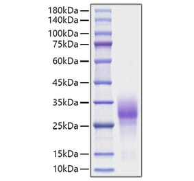 SDS-PAGE - Recombinant Human CD137 Protein (C-terminal His Tag) (A330229) - Antibodies.com