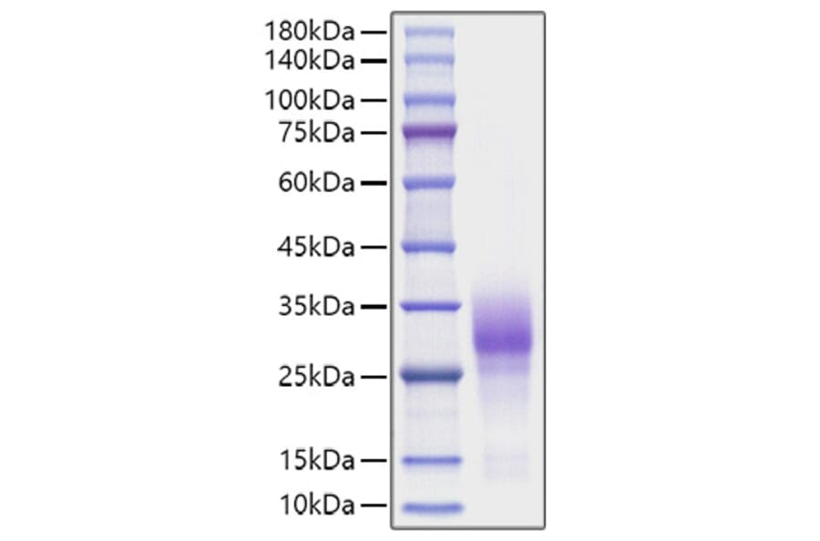 SDS-PAGE - Recombinant Human CD137 Protein (C-terminal His Tag) (A330229) - Antibodies.com