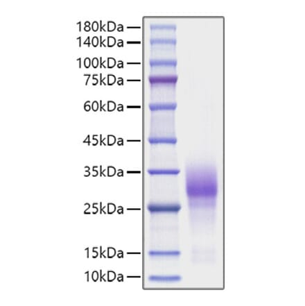 SDS-PAGE - Recombinant Human CD137 Protein (C-terminal His Tag) (A330229) - Antibodies.com