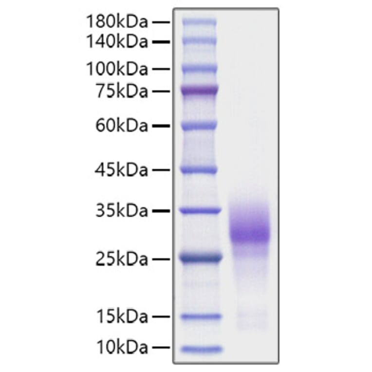 SDS-PAGE - Recombinant Human CD137 Protein (C-terminal His Tag) (A330229) - Antibodies.com
