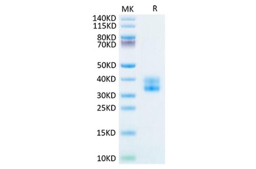 Tris-Bis PAGE - Recombinant Human CD137 Protein (Biotin) (C-terminal His and Avi Tag) (A330230) - Antibodies.com