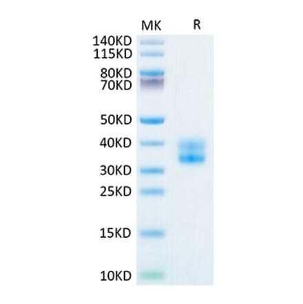 Tris-Bis PAGE - Recombinant Human CD137 Protein (Biotin) (C-terminal His and Avi Tag) (A330230) - Antibodies.com