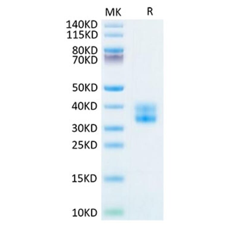 Tris-Bis PAGE - Recombinant Human CD137 Protein (Biotin) (C-terminal His and Avi Tag) (A330230) - Antibodies.com