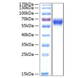 SDS-PAGE - Recombinant Human CD137 Protein (C-terminal Human Fc and His Tag) (A330231) - Antibodies.com