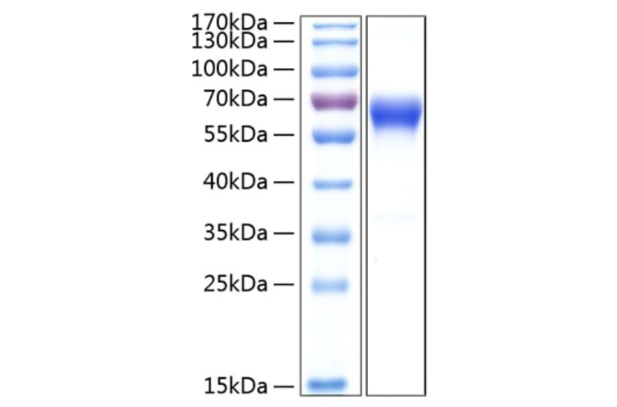 SDS-PAGE - Recombinant Human CD137 Protein (C-terminal Human Fc and His Tag) (A330231) - Antibodies.com
