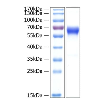 SDS-PAGE - Recombinant Human CD137 Protein (C-terminal Human Fc and His Tag) (A330231) - Antibodies.com