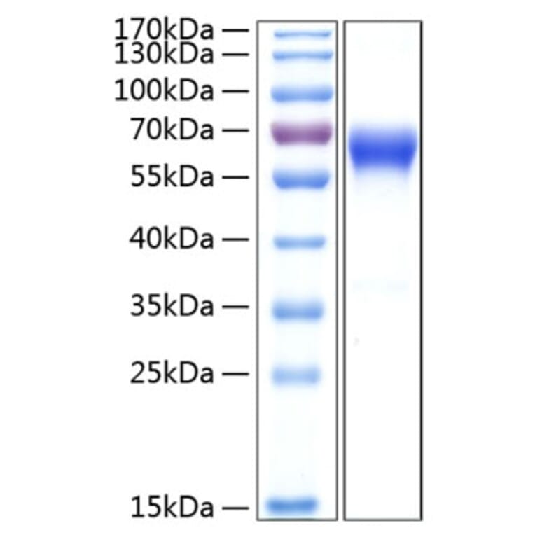 SDS-PAGE - Recombinant Human CD137 Protein (C-terminal Human Fc and His Tag) (A330231) - Antibodies.com