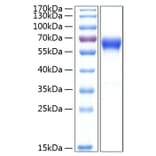 SDS-PAGE - Recombinant Human CD137 Protein (C-terminal Human Fc and His Tag) (A330231) - Antibodies.com
